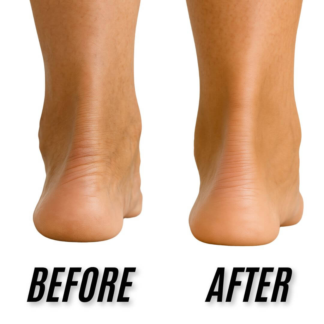 SoleEase™ Magnetic Insoles