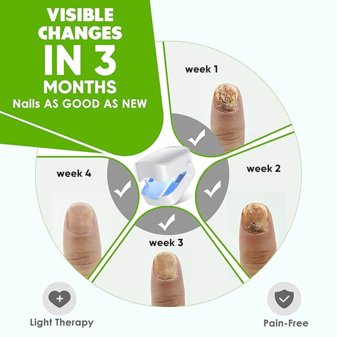 CuraToe™ – Light Therapy for Toenails
