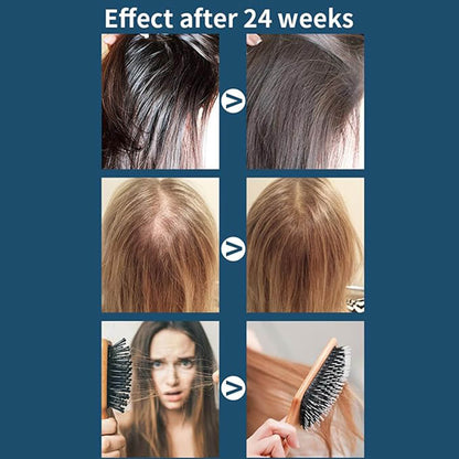 FolliCure™ – Laser Hair Regrowth Cap for Men