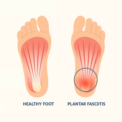 SoleEase™ Magnetic Insoles