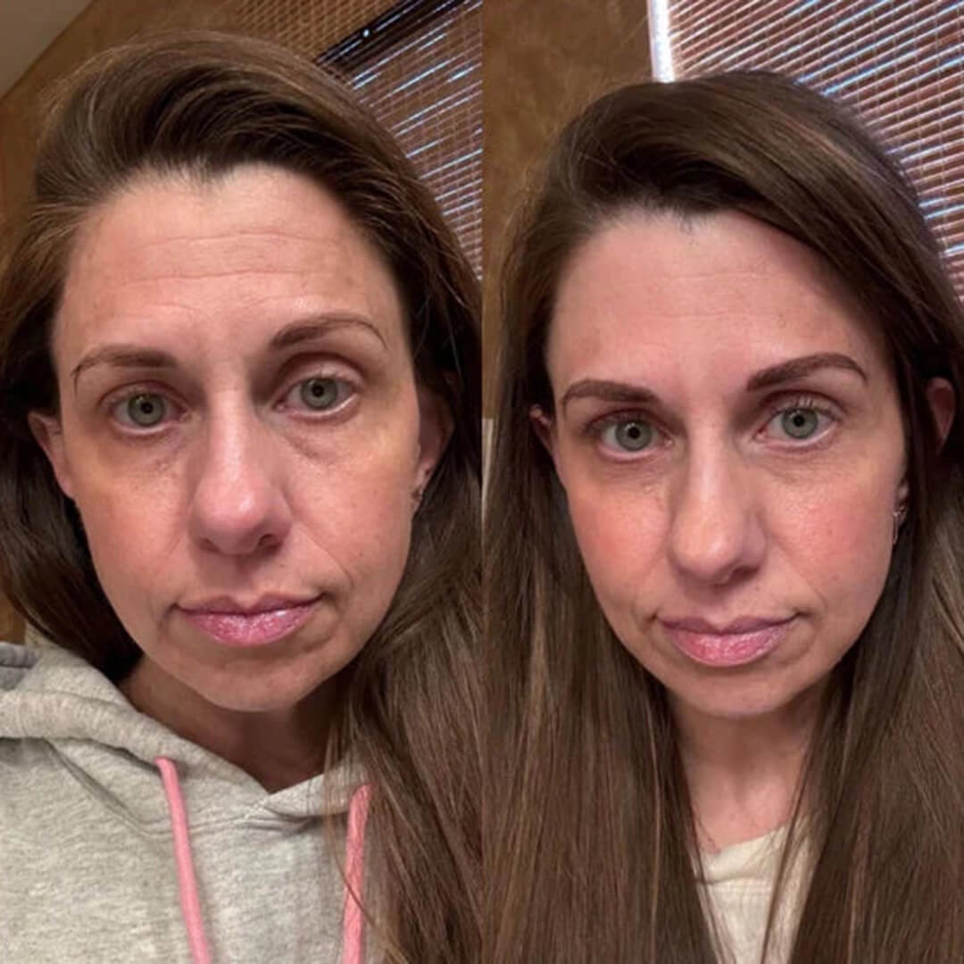 GlowSha™ Germanium Stone Face Roller