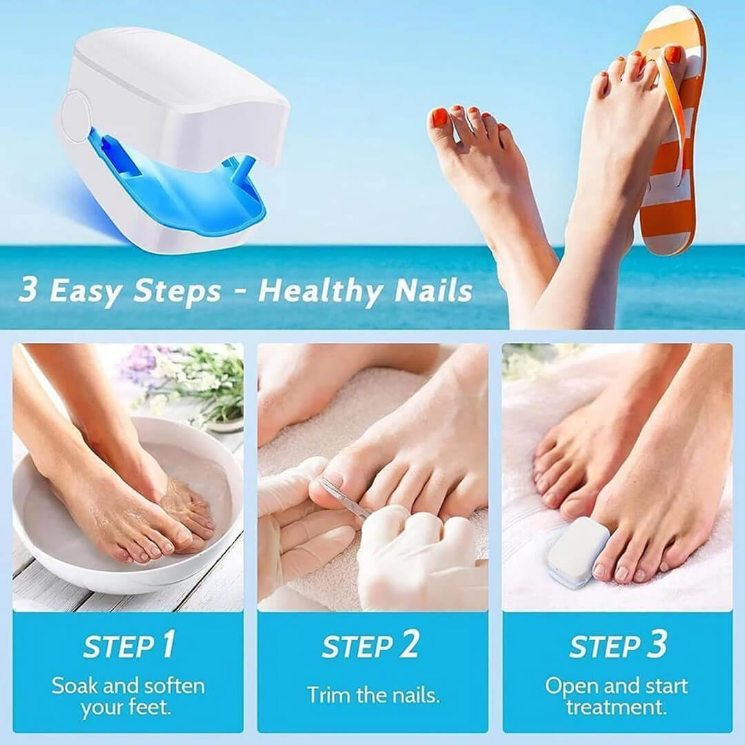 CuraToe™ – Light Therapy for Toenails