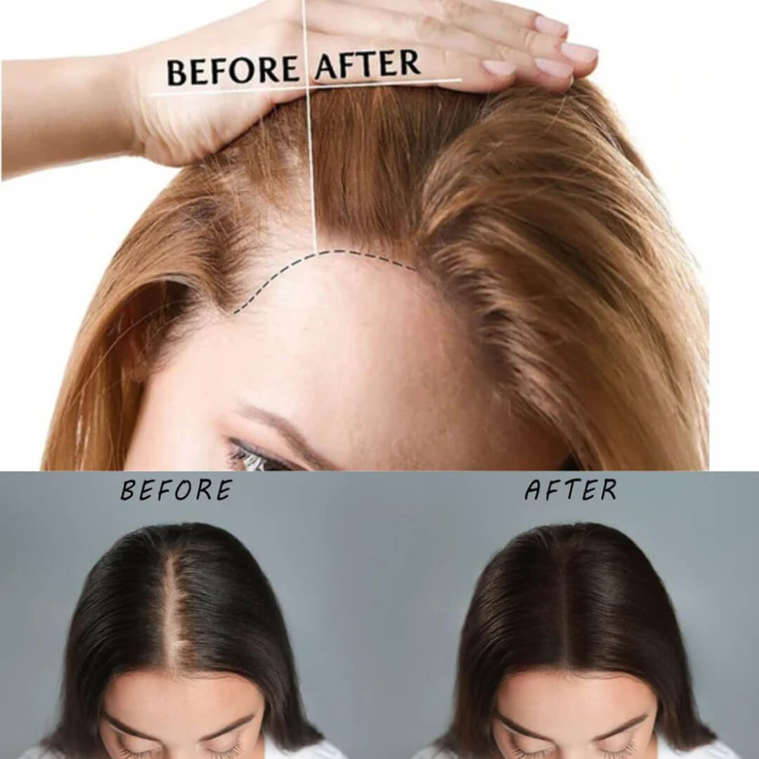 FolliCure™ – Laser Hair Regrowth Cap for Men