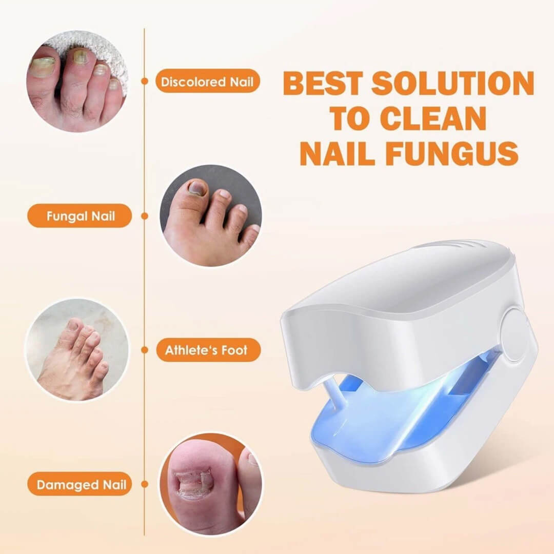 CuraToe™ – Light Therapy for Toenails