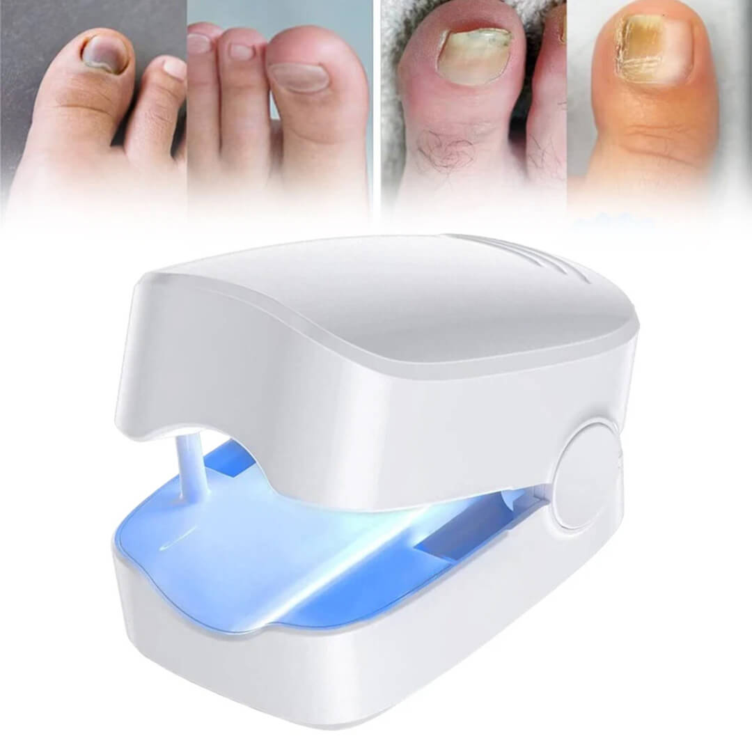 CuraToe™ – Light Therapy for Toenails