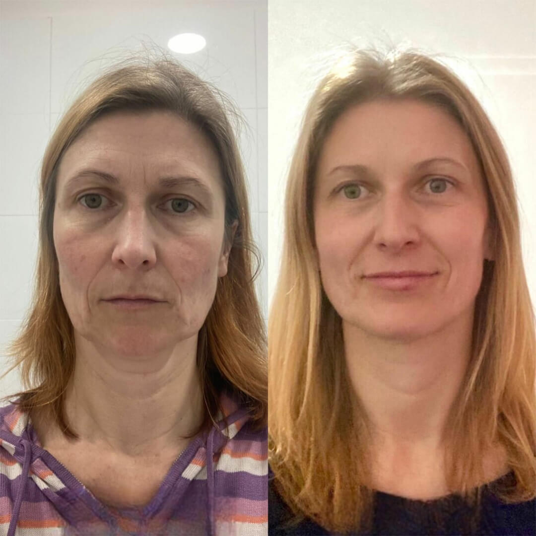 GlowSha™ Germanium Stone Face Roller